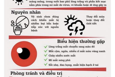 TUYÊN TRUYÊN PHÒNG CHỐNG DỊCH ĐAU MẮT ĐỎ